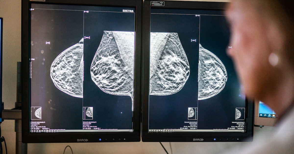 screening-kanker-snel-beter-mammografie-stelt-vrouwen-met-dicht