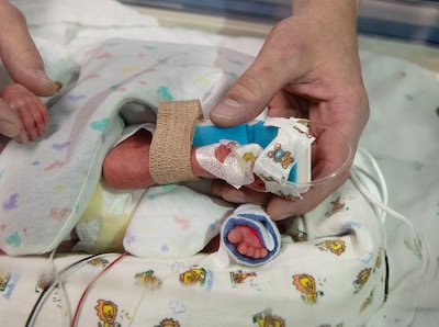 The incubator period is over, but the trauma remains: parents struggling for years