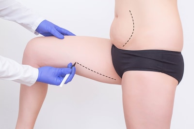 Lipofilling is becoming increasingly popular: how safe is this fat grafting procedure?