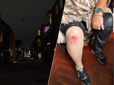 Kapotte straatverlichting zorgt voor bloedende knie en boze bewoners in Tilburgse straat: ‘Is geen v