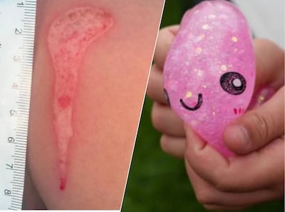 Gevaarlijke trend gaat rond op TikTok: kinderen leggen squishies in magnetron, NVWA waarschuwt