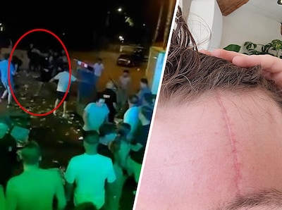 Siem (19) stond een biertje te drinken, tot een autokrik zijn voorhoofd raakte: ‘Vanaf toen weet ik niets meer’