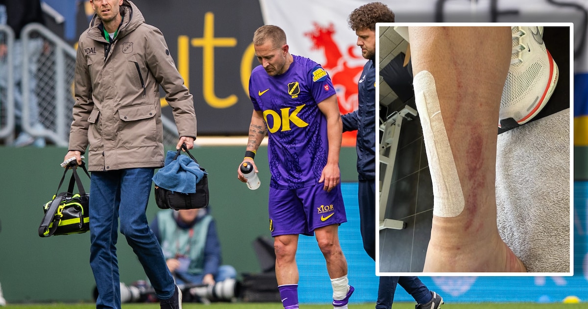 Hoefkens hekelt opmerking van scheidsrechter over diepe snijwond bij NAC-speler: ‘Belachelijk’