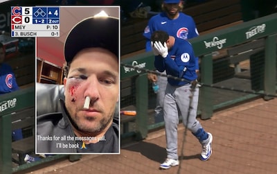 Honkballer Chicago Cubs krijgt foutslag ploeggenoot van ruim 150 km/uur in zijn gezicht