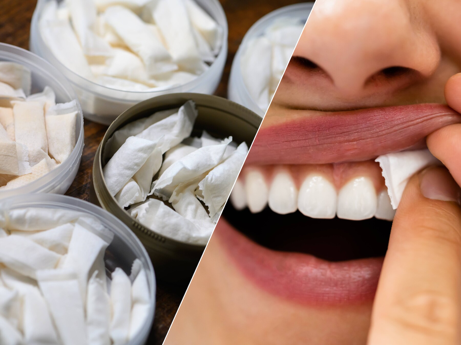 Zo ongezond is snus: ‘Het vergroot de kans op mond- en keelkanker’