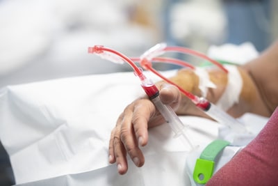 Kunnen nierpatiënten straks zonder dialyse? Onderzoek naar veelbelovende biokunstnier begint in Utrecht