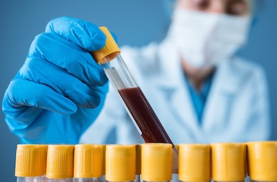 PFAS breekt nauwelijks af, hoe kan de hoeveelheid in je bloed dan dalen?