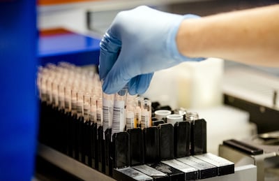Sanquin zoekt 500 nieuwe bloeddonors in Deventer