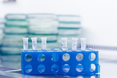 Onderzoeker (28) overleden na uitbraak gevaarlijk pestvirus in Russisch lab: honderden mensen in quarantaine