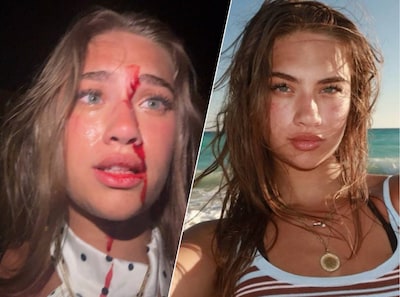 Influencer uit VS beschuldigt Nederlander van ‘glas in gezicht gooien’ en schakelt Nederlandse advocaat in