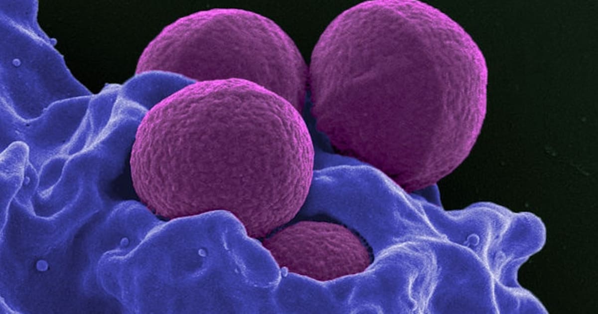 MRSA gaat rond onder studenten in Randstad, bacterie onder meer ...