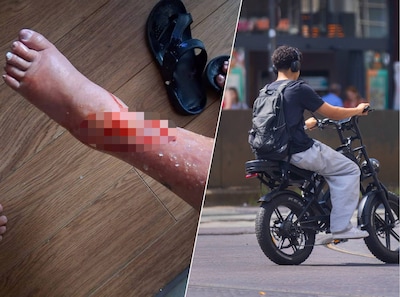 Jolanda (66) werd in haar scootmobiel tot bloedens toe bekogeld met eieren: ‘Ze kiezen makkelijk slachtoffer’