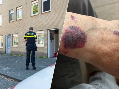 Terwijl Bas met blindenstok naar huis loopt, wordt hij beroofd van dierbaar horloge: ‘Hoe háál je het in je hoofd?'