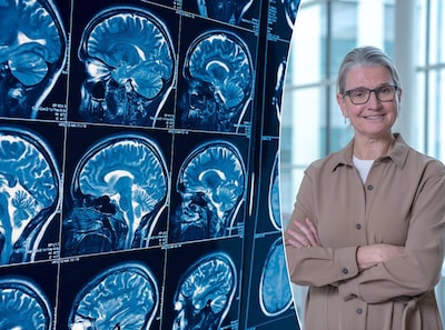 Single pill significantly reduces risk of new stroke after brain hemorrhage, study shows