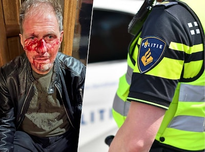 VVD-raadslid gewond na ‘laf geweld’: ‘Ik vermoed dat dader geoefende vechtsporter is’