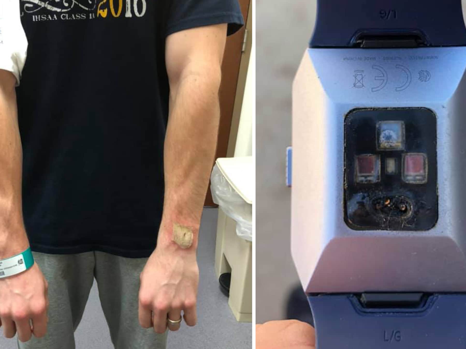 Wij liepen een week rond met de Fitbit Charge 5: dit zijn onze bevindingen