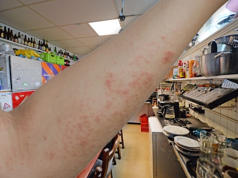 Fotobewerking ter illustratie: schurft rukt op in Utrechtse studentenhuizen. Het studentenhuis op de foto heeft niks met de schurftuitbraak te maken.