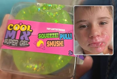 Frankrijk kondigt onderzoek aan naar ontplofte squishy waarbij 8-jarig jongetje brandwonden opliep