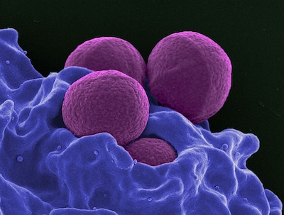 MRSA-besmettingen onder studenten in de Randstad, waaronder Delft