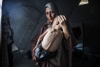 Controverse om schokkende foto uit Gaza: uitgemergelde en zieke Muhammad (1) nu inzet van propagandaoorlog