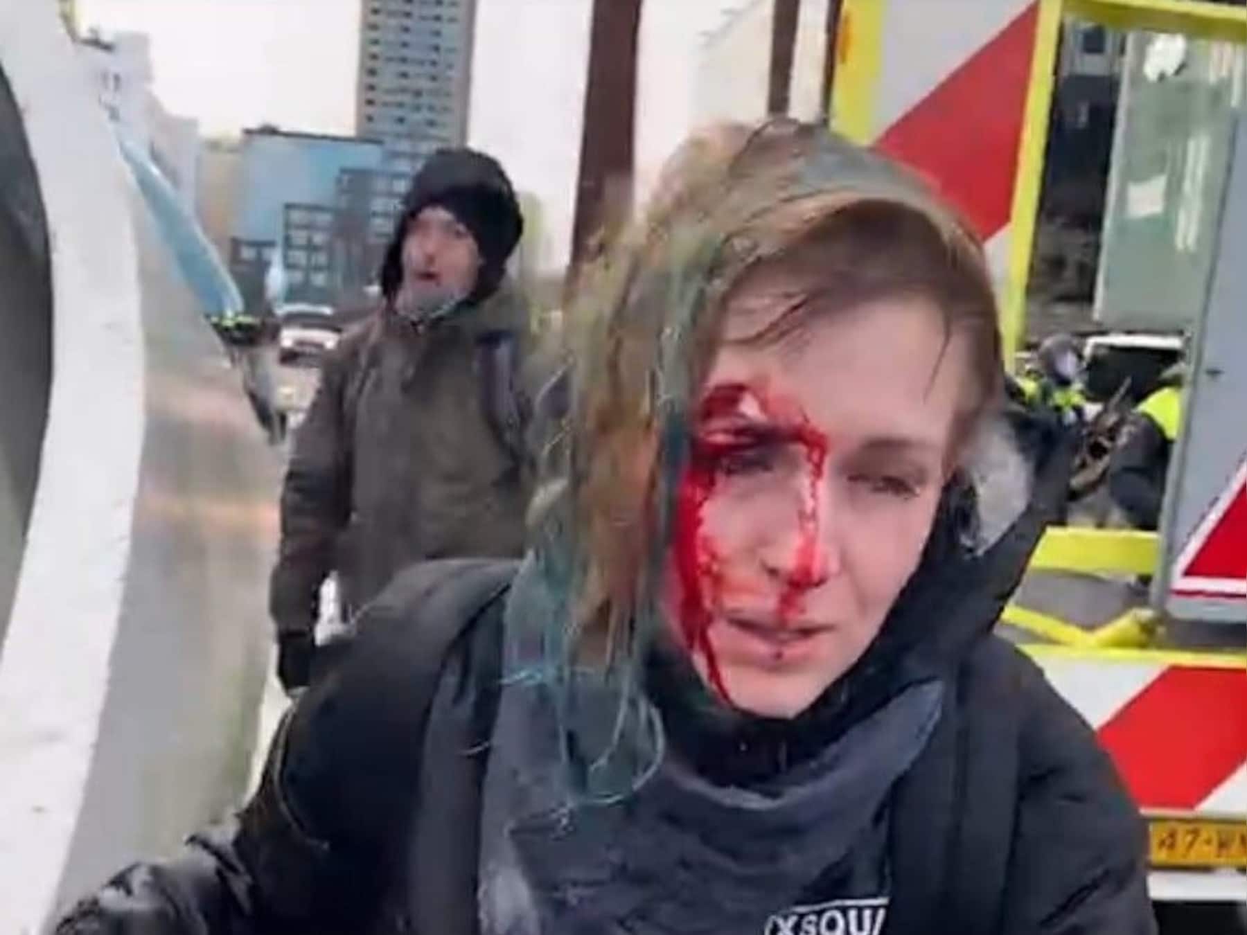 Met een bebloed gezicht loopt Denisa Štastná richting station nadat ze door een waterkanon is geraakt.