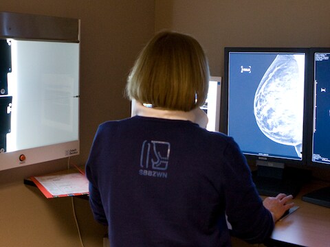 Meer jonge vrouwen krijgen borstkanker: ongezonde leefstijl speelt grotere rol dan hormonen