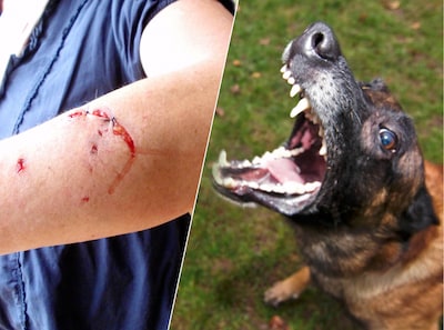 Bijtende honden zorgen voor 40.000 gewonden per jaar: dit moet je direct doen als het jou overkomt