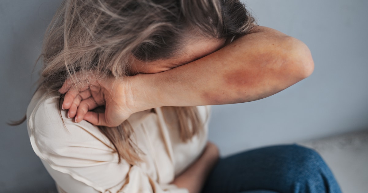 Duo veroordeeld na zware mishandeling van vrouw in haar eigen woning: ‘Heel fors geweld gebruikt’