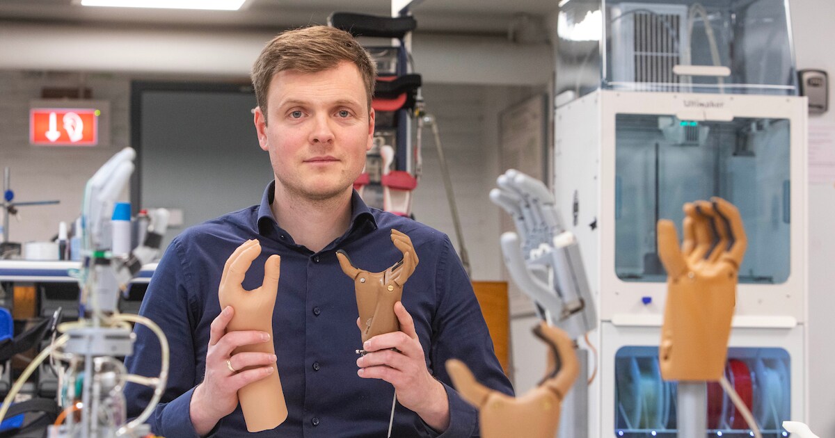 Betaalbare 3D-geprinte handprothese van Gerwin helpt ...